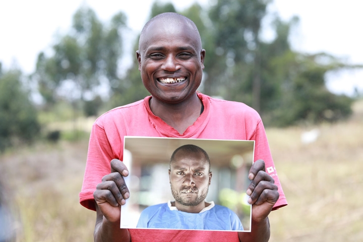 Wesley smiling, holding a picture of himself before cleft surgery