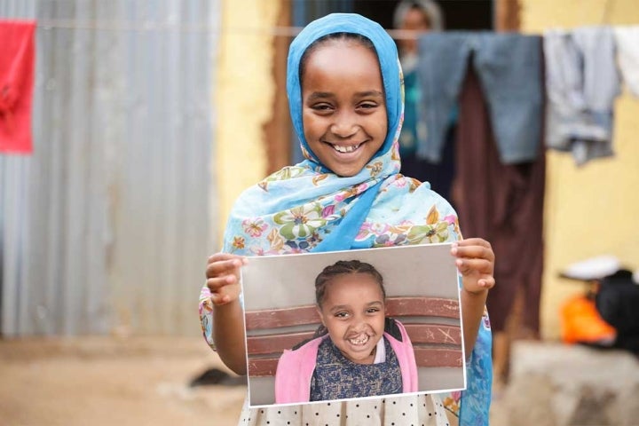 Mariam smiling and holding a photo of herself before cleft surgery