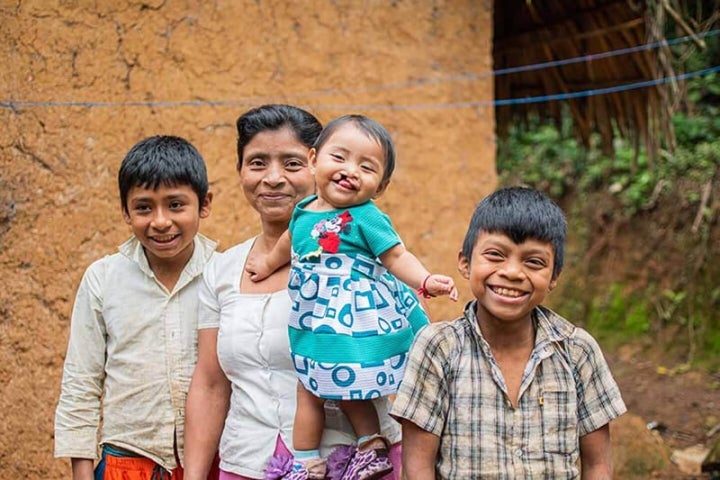 Mother smiling with her sons and cleft-affected daughter before their surgery