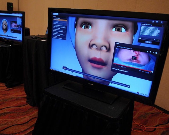 Screen with images from virtual surgery simulator
