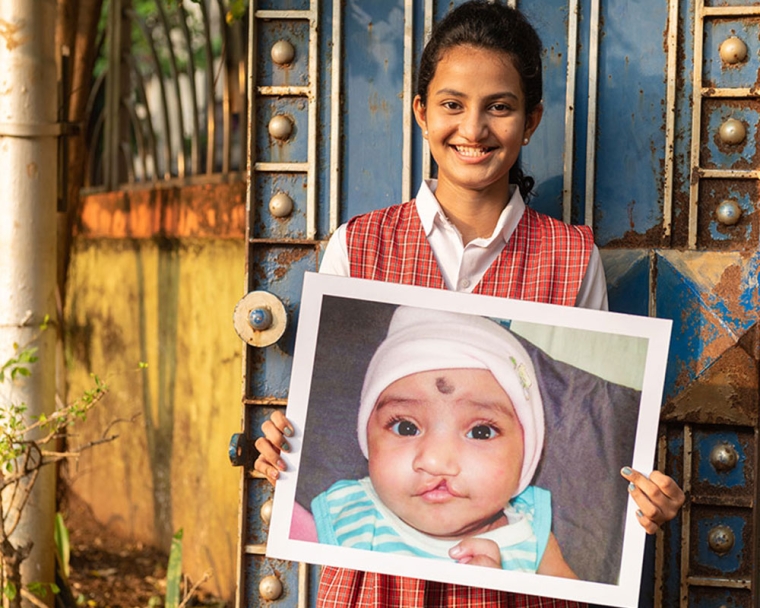Bhargavi smiling and holding a picture of herself before cleft surgery
