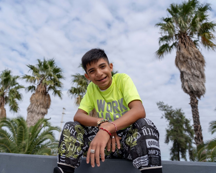 Bautista sitting and smiling after his cleft surgery