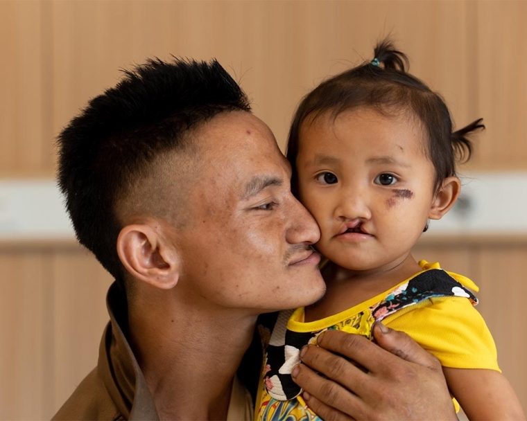 La Vang smiling and holding Nalee before her cleft surgery