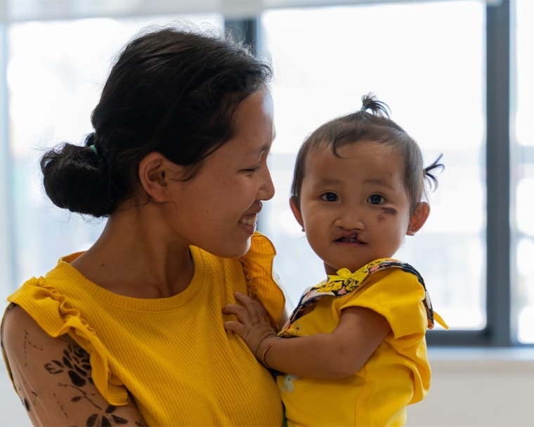 Ming Lao smiling and holding Nalee before her cleft surgery