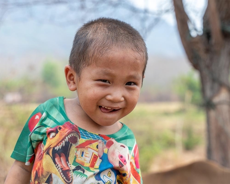 Jingtee smiling after his cleft surgery