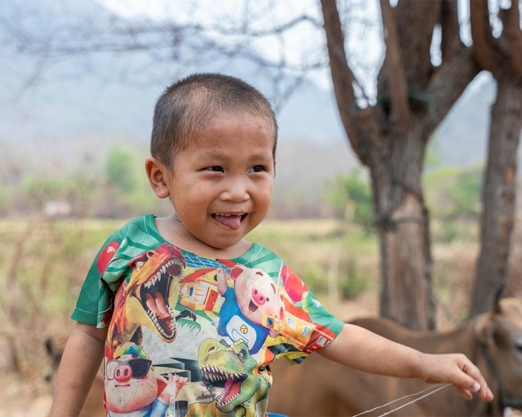 Jingtee smiling after his cleft surgery