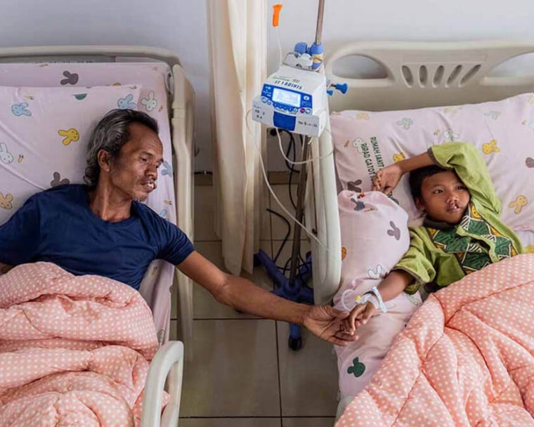 Alim reaching out to Rajib in the treatment centre before their cleft surgeries
