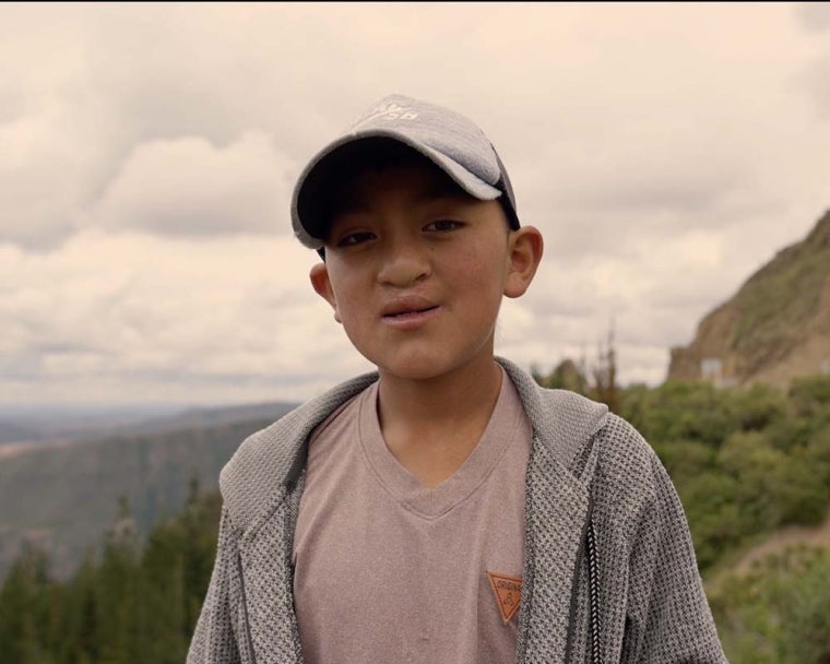 Diego smiling after cleft surgery